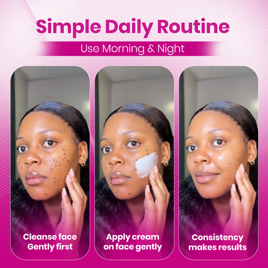 Elara® Alpha Arbutin+ TXA Cream | Korean Advanced Arbutin Brightening Cream